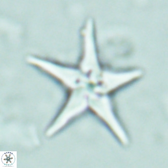 Discoaster sublodoensis VR 02656