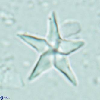 Discoaster sublodoensis VR 02657