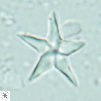 Discoaster sublodoensis VR 02657