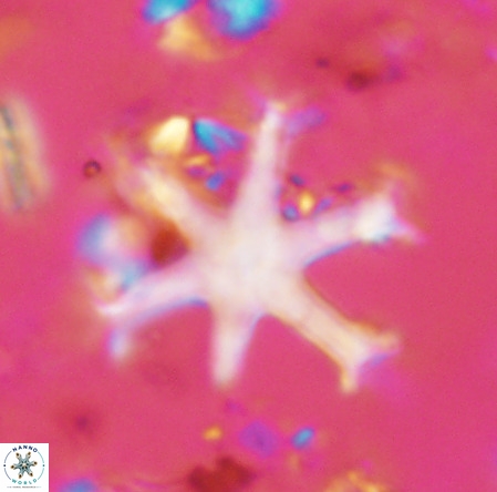 Discoaster surculu VR 10063