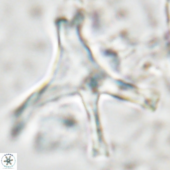 Discoaster surculus pullumpedes VR 08439