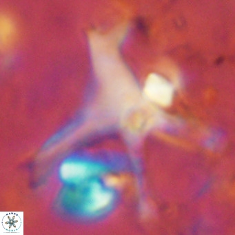 Discoaster surculus pullumpedes VR 08444