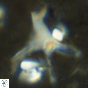 Discoaster surculus pullumpedes VR 08445