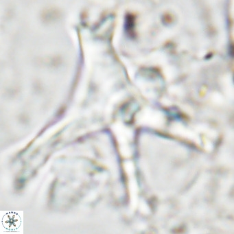Discoaster surculus pullumpedes VR 08440