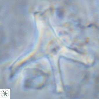 Discoaster surculus pullumpedes VR 08441