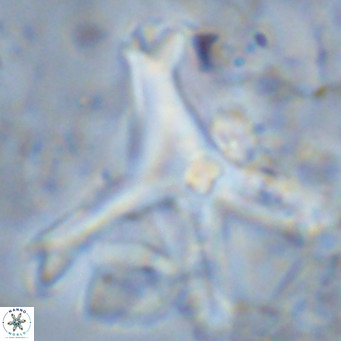 Discoaster surculus pullumpedes VR 08442
