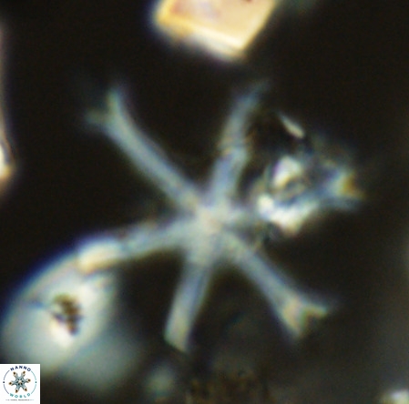 Discoaster surculus VR 06287