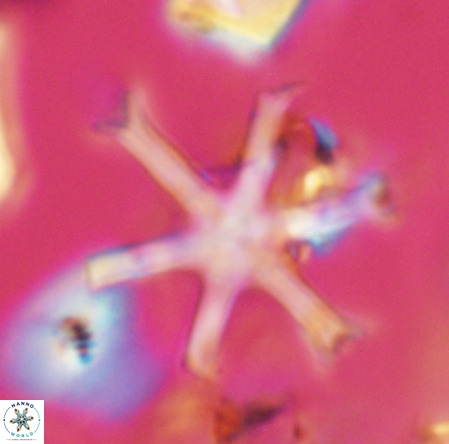 Discoaster surculus VR 06288