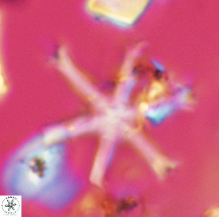 Discoaster surculus VR 06289