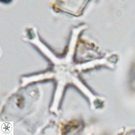Discoaster surculus VR 06283