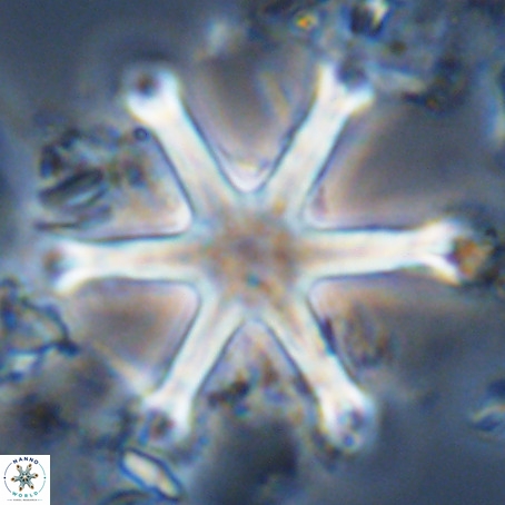Discoaster surculus VR 06294