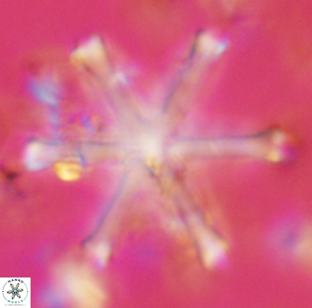 Discoaster surculus VR 06296