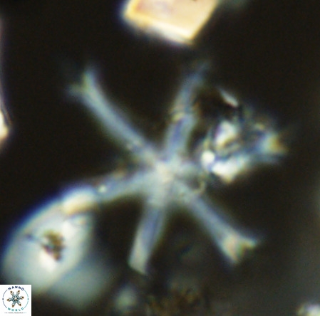 Discoaster surculus VR 06290