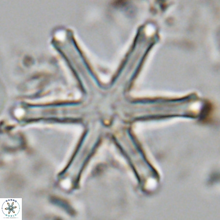 Discoaster surculus VR 06291