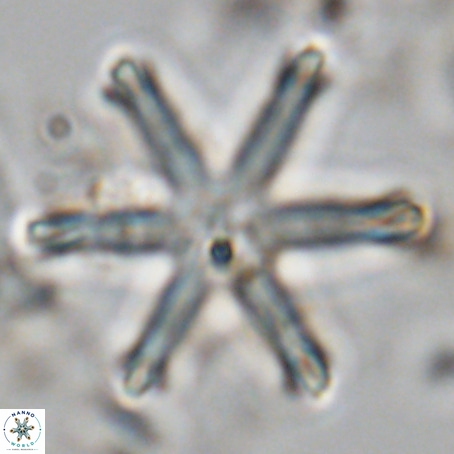 Discoaster surculus VR 06292