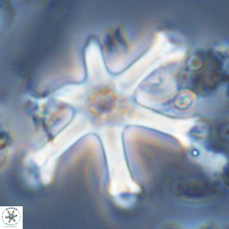 Discoaster surculus VR 06339