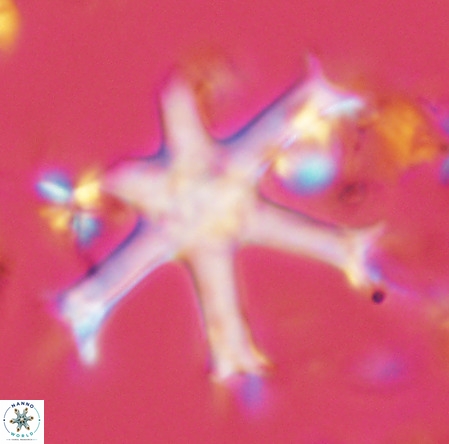 Discoaster surculus VR 06349
