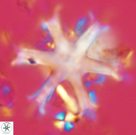 Discoaster surculus VR 06826