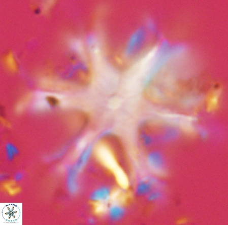 Discoaster surculus VR 06827