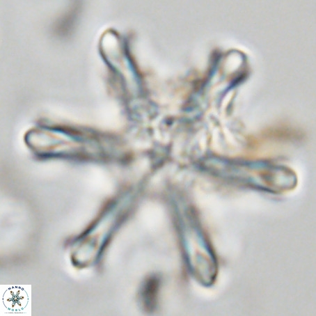Discoaster surculus VR 06822