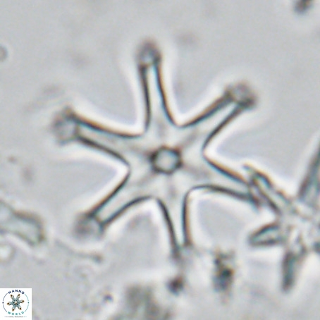 Discoaster surculus VR 08125