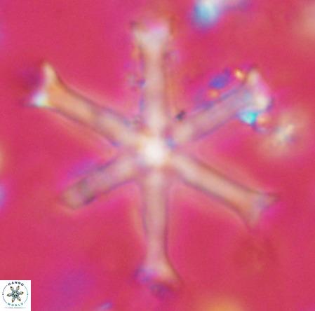 Discoaster surculus VR 10307