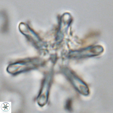 Discoaster surculus VR 10339