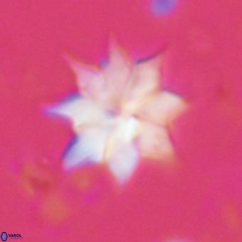 Discoaster saipanensis VR 02748