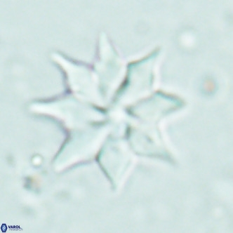 Discoaster saipanensis VR 02749