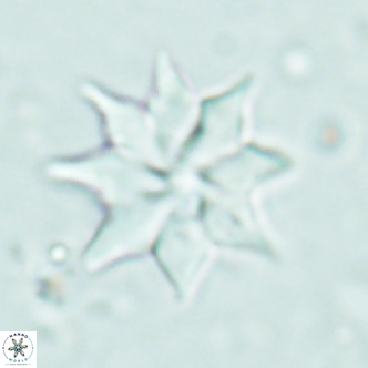 Discoaster saipanensis VR 02749