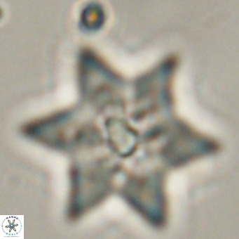Discoaster saipanensis VR 34382