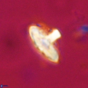 Discoaster salisburgensis VR 29165