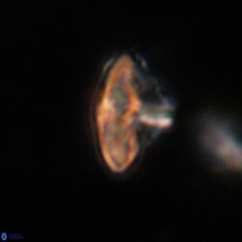 Discoaster salisburgensis VR 29167