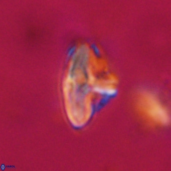 Discoaster salisburgensis VR 29168
