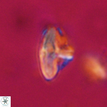 Discoaster salisburgensis VR 29168
