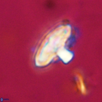 Discoaster salisburgensis VR 29169