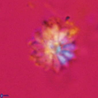 Discoaster salisburgensis VR 29161