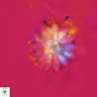 Discoaster salisburgensis VR 29161