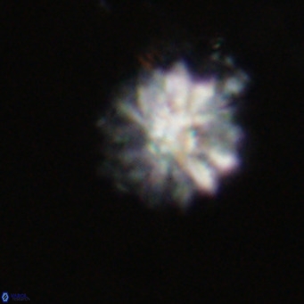 Discoaster salisburgensis VR 29162