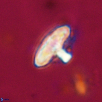 Discoaster salisburgensis VR 29171