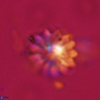 Discoaster salisburgensis VR 29186