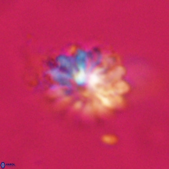 Discoaster salisburgensis VR 29187