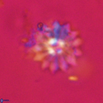 Discoaster salisburgensis VR 29188