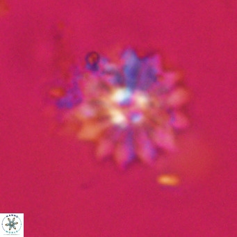 Discoaster salisburgensis VR 29188