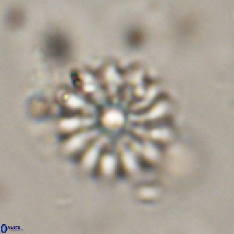 Discoaster salisburgensis VR 29194