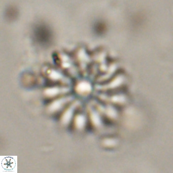 Discoaster salisburgensis VR 29194