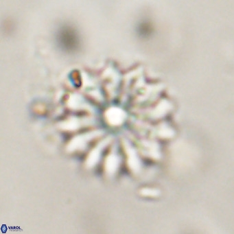 Discoaster salisburgensis VR 29195