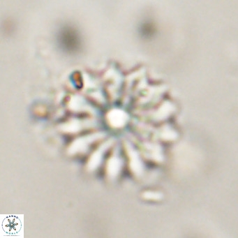 Discoaster salisburgensis VR 29195