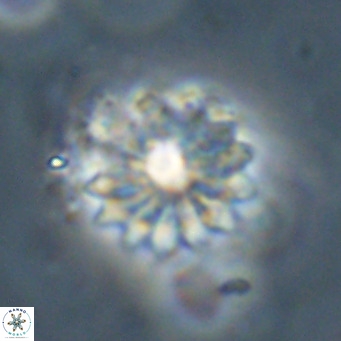 Discoaster salisburgensis VR 29196
