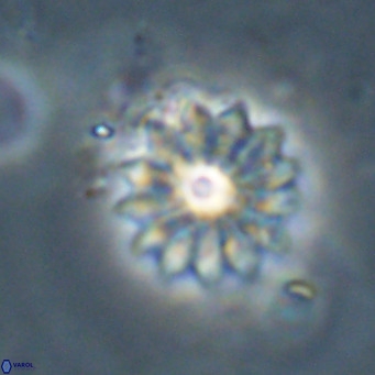 Discoaster salisburgensis VR 29197
